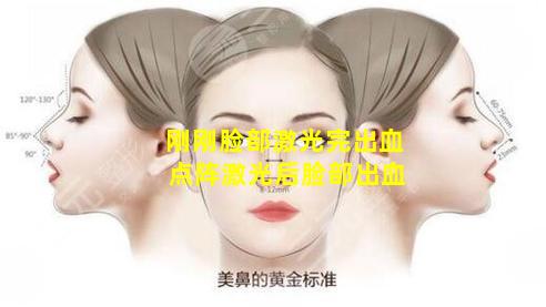 刚刚脸部激光完出血 点阵激光后脸部出血